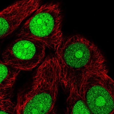 Immunocytochemistry/Immunofluorescence: TNPO2 Antibody [NBP2-57553] - Staining of human cell line MCF7 shows localization to nucleus & nucleoli.
