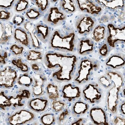 Immunohistochemistry: C21orf62 Antibody [NBP1-88947] - Staining of human kidney shows membranous positivity in renal tubules.