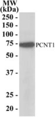 Western Blot: Nucleoporin NUP85/Pericentrin 1 Antibody [NB100-1355] - NB100-1355 (1 ug/ml) staining of Hela lysate (35 ug protein in RIPA buffer). Primary incubation was 1 hour. Detected by chemiluminescence.