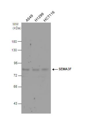 Western Blot: Semaphorin 3F Antibody [NBP2-15113] - Various whole cell extracts (30 ug) were separated by 7.5% SDS-PAGE, and the membrane was blotted with SEMA3F antibody diluted at 1:1000.