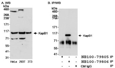 Western Blot: Importin beta Antibody [NB100-79806] - Detection of KapB1 by Western Blot and  Immunoprecipitation. Samples: A. Whole cell lysate (50 mcg)  from HeLa, 293T and mouse 3T3 cells. B. Whole cell lysate (1  mg for IP, 1/4 of IP loaded/lane) from HeLa cells. Antibodies:  Affinity purified rabbit anti-KapB1 antibody BL1964 (Cat. No.  NB100-79806) used at 0.1 mcg/ml for WB (A and B) and at 3  mcg/mg lysate for IP (B). Immunoprecipitation of KapB1 was  unsuccessful when using rabbit anti-KapB1 antibody BL1962  (Cat. No. NB100-79805) at 3 mcg/mg lysate. Detection:  Chemiluminescence with an exposure time of 30 seconds (A and  B).  25043 West