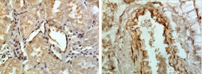 Immunohistochemistry-Paraffin: BAFF Receptor Antibody (7J21) [NBP2-22005] - The Kidney tissue samples from the Folic Acid induced kidney injury model were fixed using 4% PFA at 4C for overnight and embeded in paraffin. 4um section was sublected to IHC with NBP2-22005
