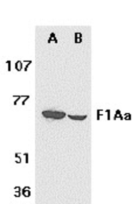 Western Blot: F1Aa Antibody [NB100-94242] - Western blot analysis of F1Aá in mouse (A) and rat (B) liver tissue lysates with anti- F1Aá at 1 ug /ml.