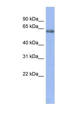 Western Blot: GABA Receptor Epsilon Antibody [NBP1-80068] - Human Stomach, concentration 0.2-1 ug/ml.