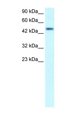 Western Blot: CREB3 regulatory factor Antibody [NBP1-79997] - Human Lung lysate, concentration 0.2-1 ug/ml.