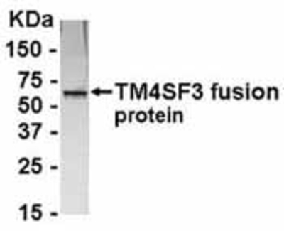 Western Blot: E coli-derived fusion protein as test antigen. Affinity-purified IgY dilution: 1:2000, Goat anti-IgY-HRP dilution: 1:1000. Colorimetric method for signal development. ( anti-TSPAN8 )