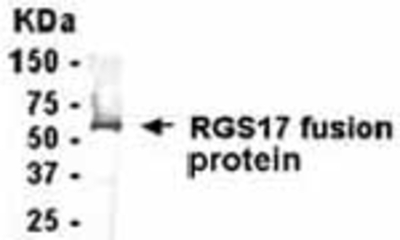 Western Blot: E coli-derived fusion protein as test antigen. Affi-pure IgY dilution: 1:2000, Goat anti-IgY-HRP dilution: 1:1000. Colorimetric method for signal development. ( anti-RGS17 )