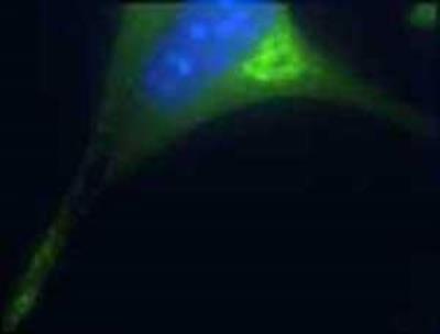 Immunocytochemistry/Immunofluorescence: AP3B2 Antibody [NB120-14227] - ICC: Immunocytochemistry staining of endogenous AP3B2 in AtT-20 cells. Anti-AP3B2 IgY dilution: 1:200; Donkey anti-IgY Fc-FITC: 1:200. ( anti-AP3B2 )