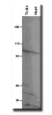 Western Blot: PDE8B Antibody [NB300-644] - Western Blot of PDE8B using rat testis and heart membranes. Antibody (NB300-644) dilution 1:500. Molecular weight marker positions are marked on the left.