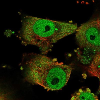 Immunocytochemistry/Immunofluorescence: GPATCH3 Antibody [NBP2-58803] - Staining of human cell line U-251 MG shows localization to nucleoplasm & cytosol.