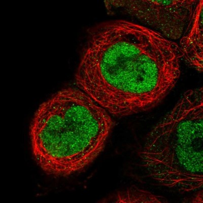 Immunocytochemistry/Immunofluorescence: RNASEH2B Antibody [NBP2-58962] - Staining of human cell line A-431 shows localization to nucleoplasm.