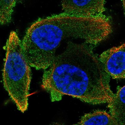 Immunocytochemistry/Immunofluorescence: Phospholipase C beta 2 Antibody [NBP2-58951] - Staining of human cell line PC-3 shows localization to cytosol.