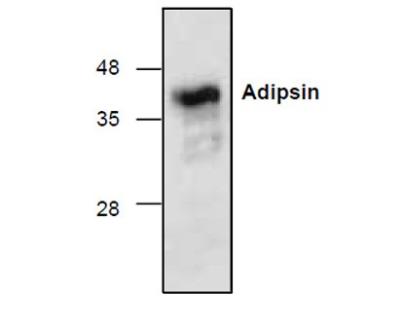 Western Blot: Complement Factor D/Adipsin Antibody [NBP1-50652] - Adipsin with rat kidney tissue lysate.