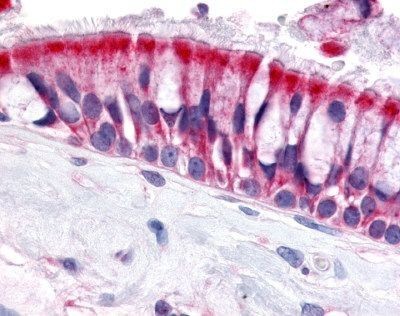 Immunohistochemistry-Paraffin: Olfactory Receptor OR6N1 Antibody [NLS3227] - Analysis of anti-OR6N1 antibody with nasal mucosa, respiratory epithelium.