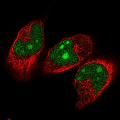 Immunocytochemistry/Immunofluorescence: NVL Antibody [NBP2-58764] - Staining of human cell line RH-30 shows localization to nucleus & nucleoli.