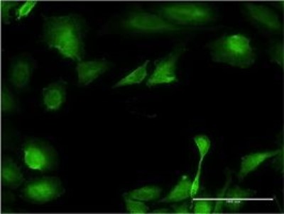 Immunocytochemistry/Immunofluorescence: B3GNT3 Antibody (1A2) [H00010331-M01] - Analysis of monoclonal antibody to B3GNT3 on HeLa cell. Antibody concentration 10 ug/ml.