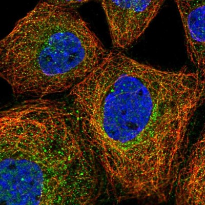 Immunocytochemistry/Immunofluorescence: PRMT10 Antibody [NBP2-59016] - Staining of human cell line A-431 shows localization to cytosol & microtubules.