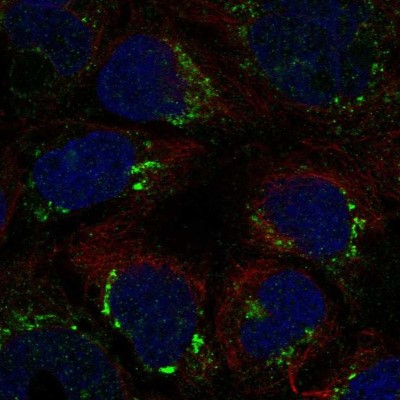 Immunocytochemistry/Immunofluorescence: ATP7b Antibody [NBP2-58923] - Staining of human cell line CACO-2 shows localization to the Golgi apparatus.