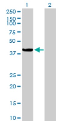 Western Blot: C9orf100 Antibody [H00084904-B01P] - Analysis of C9orf100 expression in transfected 293T cell line by C9orf100 polyclonal antibody.  Lane 1: C9orf100 transfected lysate(36.96 KDa). Lane 2: Non-transfected lysate.