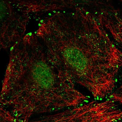 Immunocytochemistry/Immunofluorescence: LIMD1 Antibody [NBP2-56448] - Staining of human cell line A549 shows localization to nucleus & focal adhesion sites.