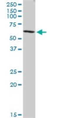 Western Blot: Coronin-2B Antibody [H00010391-B01P] - Analysis of CORO2B expression in A-431.