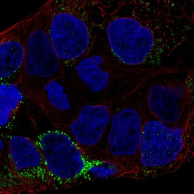 Immunocytochemistry/Immunofluorescence: CLN6 Antibody [NBP2-56415] - Staining of human cell line CACO-2 shows localization to vesicles.