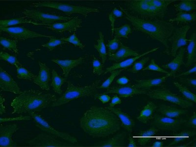 Immunocytochemistry/Immunofluorescence: Nope Antibody (6A3) [H00057722-M05] - Analysis of monoclonal antibody to IGDCC4 on HeLa cell. Antibody concentration 10 ug/ml