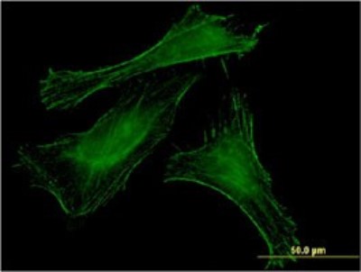 Immunocytochemistry/Immunofluorescence: MBNL2 Antibody (3C3) [H00010150-M01] - Analysis of monoclonal antibody to MBNL2 on HeLa cell. Antibody concentration 10 ug/ml.