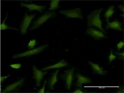 Immunocytochemistry/Immunofluorescence: Histatin 3 Antibody (4G9) [H00003347-M01] - Analysis of monoclonal antibody to HTN3 on HeLa cell. Antibody concentration 10 ug/ml.