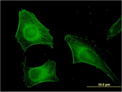 Immunocytochemistry/Immunofluorescence: FEM1B Antibody (4B12) [H00010116-M09] - Analysis of monoclonal antibody to FEM1B on HeLa cell. Antibody concentration 10 ug/ml