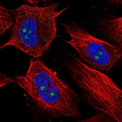 Immunocytochemistry/Immunofluorescence: RBM19 Antibody [NBP2-55043] - Staining of human cell line U-251 MG shows localization to nucleoli.