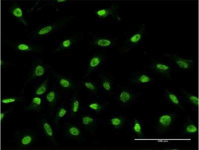 Immunocytochemistry/Immunofluorescence: RPS2 Antibody (3F5) [H00006187-M05] - Analysis of monoclonal antibody to RPS2 on HeLa cell. Antibody concentration 10 ug/ml