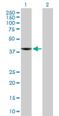 Western Blot: C8orf76 Antibody [H00084933-B01P] - Analysis of C8orf76 expression in transfected 293T cell line by C8orf76 polyclonal antibody.  Lane 1: C8orf76 transfected lysate(41.8 KDa). Lane 2: Non-transfected lysate.
