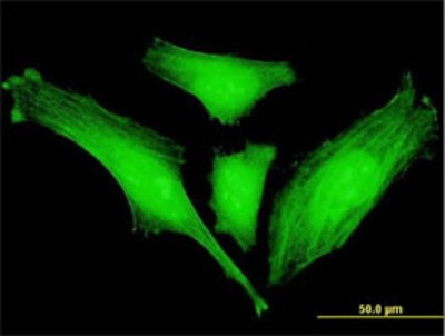 Immunocytochemistry/Immunofluorescence: SLC2A4RG Antibody (5D2) [H00056731-M01] - Analysis of monoclonal antibody to SLC2A4RG on HeLa cell. Antibody concentration 10 ug/ml.
