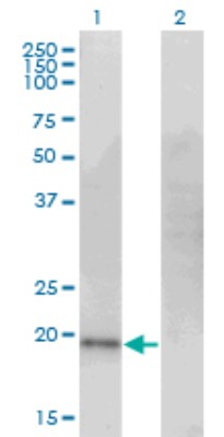 Western Blot: Cysteine Dioxygenase Type 1 Antibody (4B4) [H00001036-M09] - Analysis of CDO1 expression in transfected 293T cell line by CDO1 monoclonal antibody (M09), clone 4B4. Lane 1: CDO1 transfected lysatE (23 KDa). Lane 2: Non-transfected lysate.