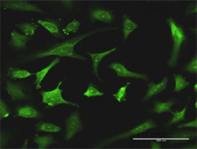 Immunocytochemistry/Immunofluorescence: Exosome component 8 Antibody (4B3) [H00011340-M02] - Analysis of monoclonal antibody to EXOSC8 on HeLa cell. Antibody concentration 15 ug/ml.