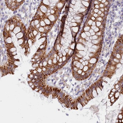 Immunohistochemistry-Paraffin: C6orf223 Antibody [NBP1-91738] - Staining of human colon shows strong cytoplasmic positivity with a granular pattern in glandular cells.
