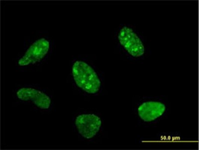 Immunocytochemistry/Immunofluorescence: POLR1C Antibody (2A5-A5) [H00009533-M02] - Analysis of monoclonal antibody to POLR1C on HeLa cell. Antibody concentration 10 ug/ml.