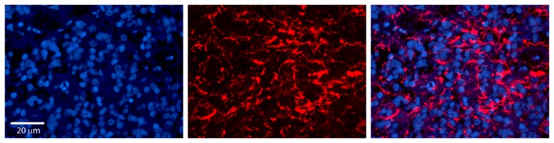 Immunocytochemistry/Immunofluorescence: LAPTM4B Antibody [NBP1-59416] - Antibodyn Formalin Fixed Paraffin Embedded Tissue: Human Pineal Tissue  Observed Staining: Membrane and cytoplasmic in  processes of pinealocytes and intersticial cells