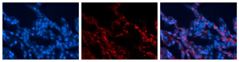 Immunocytochemistry/Immunofluorescence: SEC6 Antibody [NBP1-55109] - Formalin Fixed Paraffin; Embedded Tissue: Human Lung Tissue; Observed Staining: Cytoplasmic and membrane in alveolar type I cells; Primary Antibody Concentration: 1:100