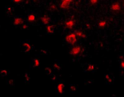 Immunocytochemistry/Immunofluorescence: SLITRK1 Antibody [NBP1-77319] - Human brain tissue.