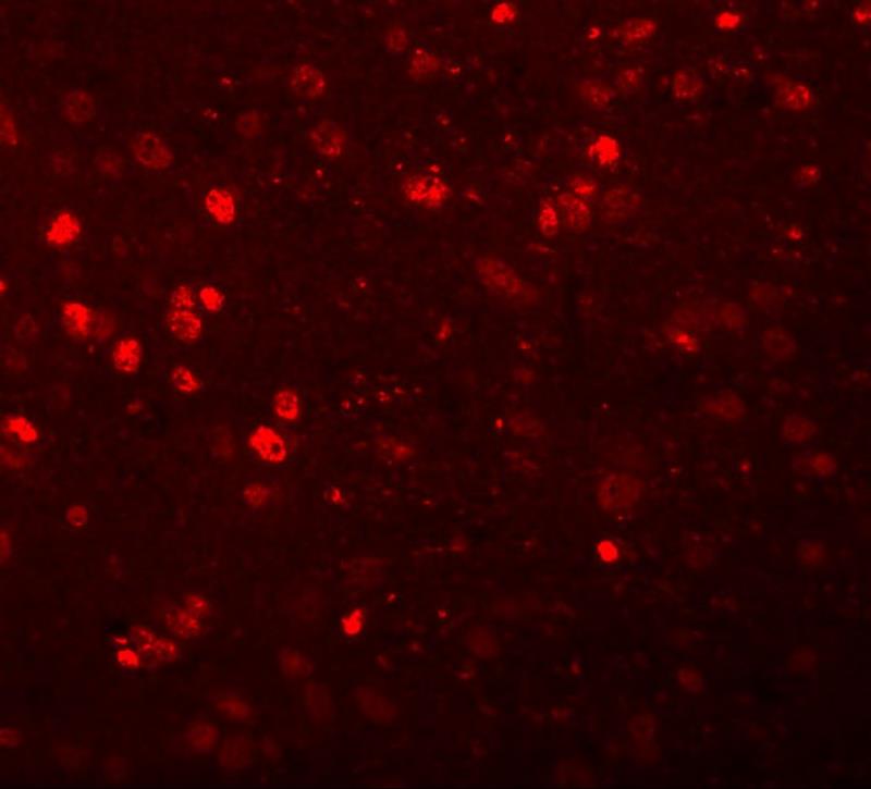 Immunocytochemistry/Immunofluorescence: Synaptogyrin 1 Antibody [NBP1-77371] - Immunofluorescence of SYNGR1 in rat brain tissue with SYNGR1 antibody at 20 ug/mL.
