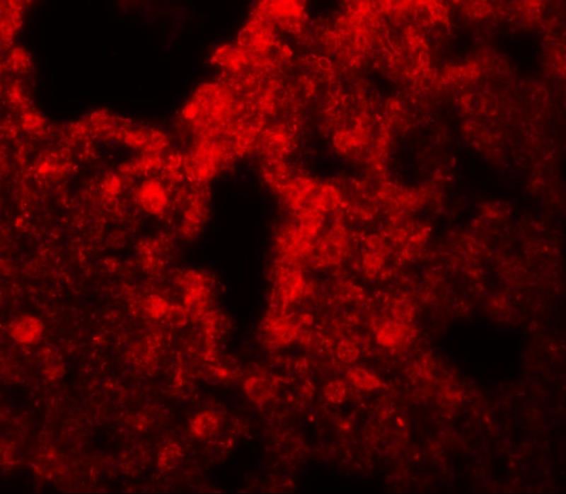 Immunocytochemistry/Immunofluorescence: SRPX2 Antibody [NBP1-77370] - Immunofluorescence of SRPX2 in human lung tissue with SRPX2 antibody at 20 ug/mL.