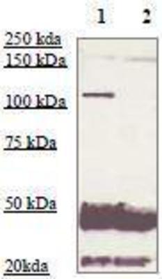Western Blot: Androgen Receptor Antibody [NBP1-74687] - 5 mg of the whole cell lysate derived from conditioned LNCaP were immunoprecipitated by 4 ug of Rabbit anti-AR (pSer210) (lane 1) or pre adsorbed by immunization peptide (lane 2) followed by rabbit anti AR (NT) at 1:500.