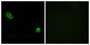 Immunocytochemistry/Immunofluorescence: PHCA Antibody [NBP1-71578] - Analysis of MCF7 cells, using PHCA Antibody. The picture on the right is treated with the synthesized peptide.