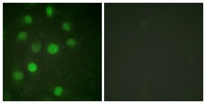 Immunocytochemistry/Immunofluorescence: Histone H1.5 Antibody [NBP1-61632] - Analysis of HuvEc cells, using Histone H1.5  Antibody. The picture on the right is treated with the synthesized peptide.