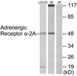 Western Blot: Alpha 2a Adrenergic Receptor Antibody [NBP1-67832] - Analysis of extracts from Jurkat/LOVO cells, using Alpha 2a Adrenergic Receptor Antibody. The lane on the right is treated with the synthesized peptide.