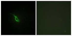 Immunocytochemistry/Immunofluorescence: Alpha 2a Adrenergic Receptor Antibody [NBP1-67832] - Analysis of NIH-3T3 cells, using Alpha 2a Adrenergic Receptor Antibody. The picture on the right is treated with the synthesized peptide.