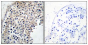 Immunohistochemistry-Paraffin: Alpha 2a Adrenergic Receptor Antibody [NBP1-67832] - Analysis of paraffin-embedded human testis tissue, using Alpha 2a Adrenergic Receptor Antibody. The picture on the right is treated with the synthesized peptide.