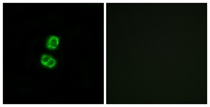 Immunocytochemistry/Immunofluorescence: FGF-22 Antibody [NBP1-68291] - Analysis of MCF7 cells, using FGF-22 Antibody. The picture on the right is treated with the synthesized peptide.